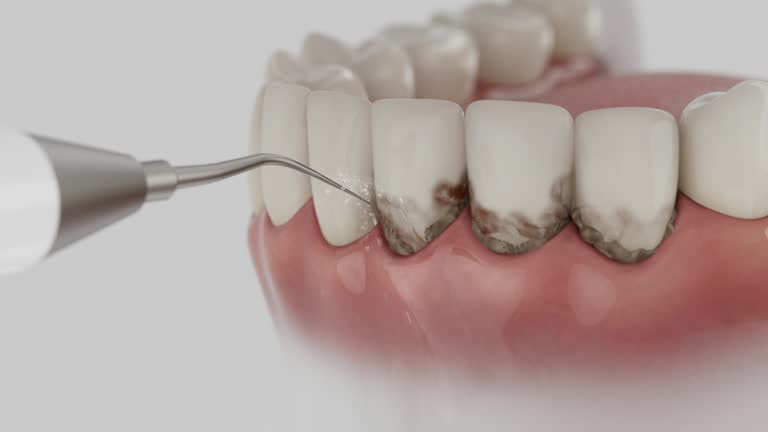 Trusted Invisalign Clear Aligners service in Owingsville, KY - Dentist Open Now